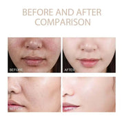 Before and after skin comparison showing improvement in complexion and texture using a moisturizing serum.